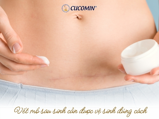 Vết mổ sau sinh cần được chăm sóc đúng cách